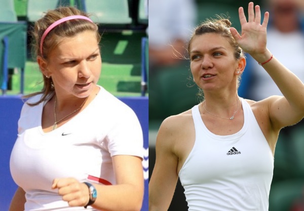 Simona Halep. Hình ảnh trước và sau khi phẫu thuật, cân nặng và chiều cao của một vận động viên quần vợt