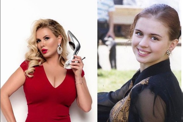 Anna Semenovich. Ảnh mặc áo tắm thời trẻ và bây giờ. Phẫu thuật thẩm mỹ, thay đổi thẩm mỹ của vận động viên trượt băng nghệ thuật