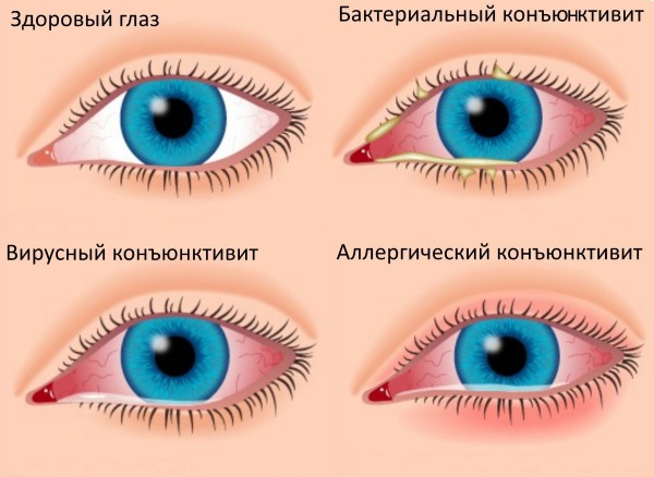 ديسبورت. ما هو هذا الإجراء في التجميل. سعر الدواء ، التعليمات ، موانع الاستعمال