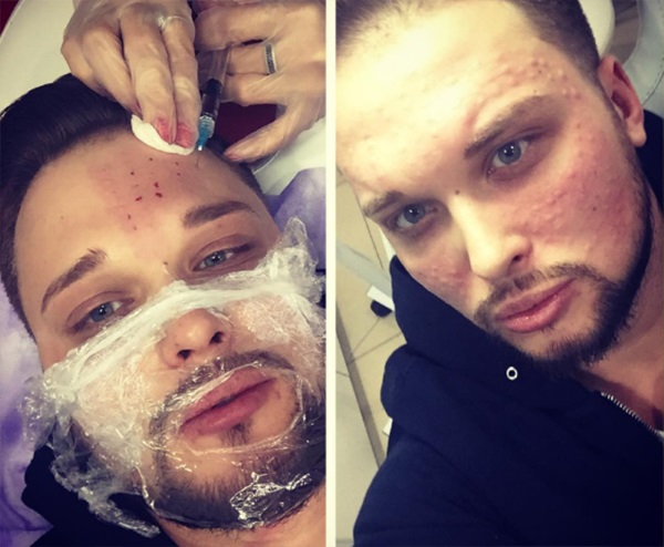 Kholyavin Egor. صور قبل وبعد عمليات التجميل ، فقدان الوزن ، حديثة ، في البيت 2 ، في شبابه ، سيرة ذاتية
