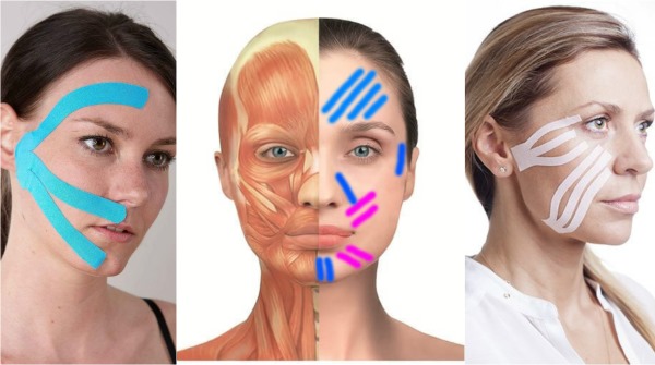 Gravação Kinesio. O que é isso em cosmetologia, medicina, esportes. Fitas, estética, drenagem linfática de rugas, dobras nasolabiais