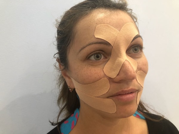 Gravação Kinesio. O que é isso em cosmetologia, medicina, esportes. Fitas, estética, drenagem linfática de rugas, dobras nasolabiais