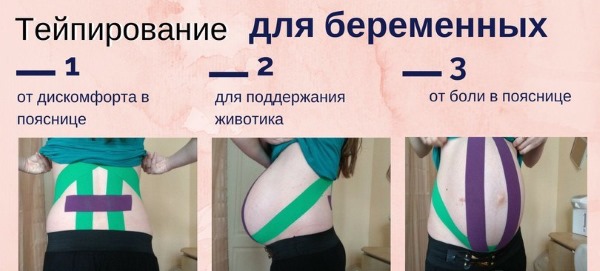 Gravação Kinesio. O que é isso em cosmetologia, medicina, esportes. Fitas, estética, drenagem linfática de rugas, dobras nasolabiais