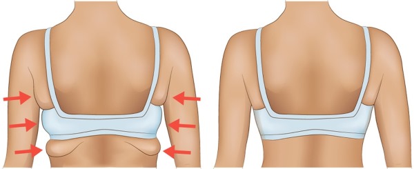 Cách đánh tan mỡ lưng ở phụ nữ tại nhà. Luyện tập thể chất