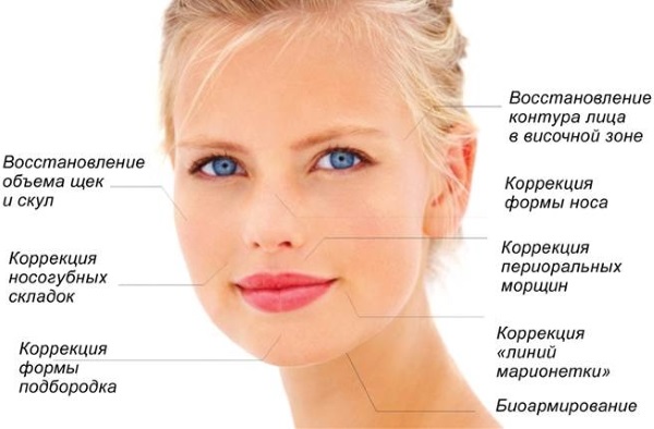 Tiêm tạo đường nét trên khuôn mặt. Nó là gì. Ảnh trước và sau, chuẩn bị, giá cả