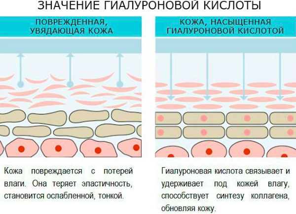 Tiêm tạo đường nét trên khuôn mặt. Nó là gì. Ảnh trước và sau, chuẩn bị, giá cả