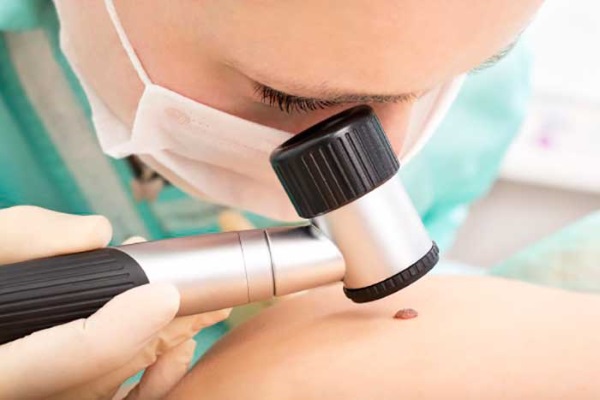 Cách tẩy nốt ruồi trên mặt bằng thẩm mỹ, phương pháp tại nhà