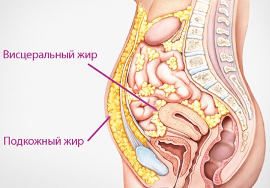 Како уклонити велики стомак код жена и мушкараца. Узроци и лекови