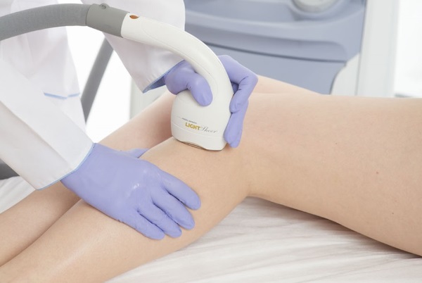 Tẩy lông bằng laser. Nó có hại cho sức khỏe không, đánh giá của bác sĩ, chống chỉ định và hậu quả. Bạn có thể làm bao lâu một lần