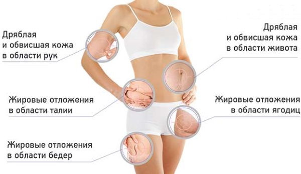 Ручна масажа лимфне дренаже. Предности, како се осећати као код куће