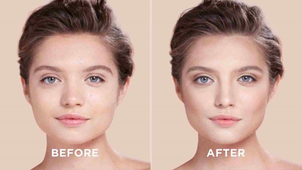 Cách sửa mũi cho nữ bằng khoai tây. Nâng mũi, hình ảnh trước và sau phẫu thuật, giá cả