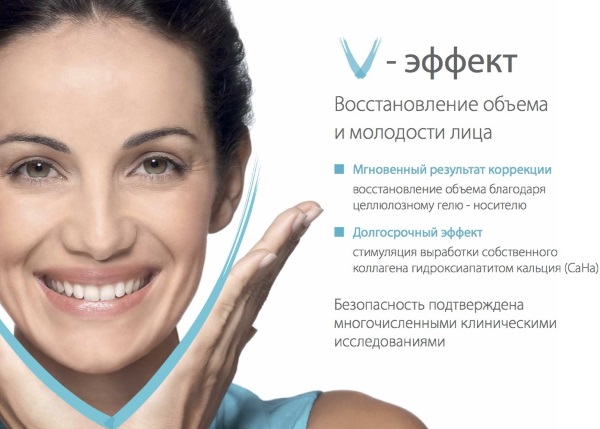Radiesse في التجميل. مراجعات لأخصائيي التجميل ، موانع الاستعمال ، العواقب