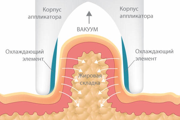 Máy mát xa chân không tốt nhất để loại bỏ cellulite. Mua gì, giá cả, cách sử dụng