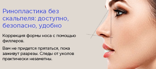تجميل الأنف غير الجراحي مع أدوية حشو. قبل وبعد الصور ، السعر
