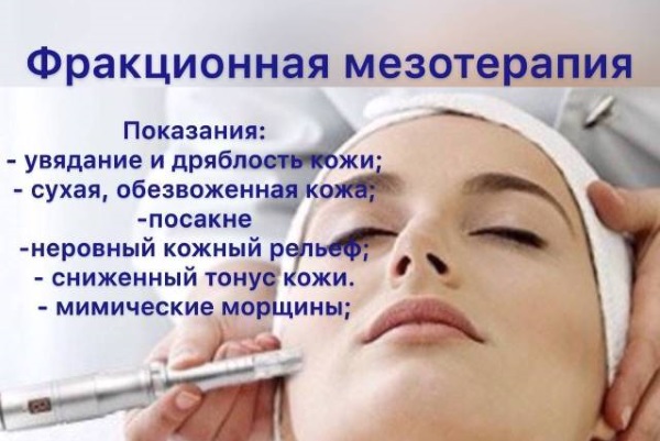 Mesoterapia facial fraccionada: indicaciones, resultados, efectos secundarios, consecuencias. Reseñas