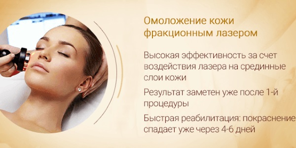 Quang nhiệt phân đoạn. Quy trình này là gì, tác dụng, nó được thực hiện như thế nào, trước và sau khi chụp ảnh, đánh giá, giá cả
