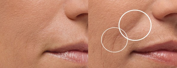 Massage cho phụ nữ 40-50 tuổi bằng tay toàn thân, chống nhăn da mặt. Các loại, hướng dẫn, ảnh, kết quả