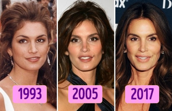 Cindy Crawford. Hình ảnh thời trẻ, những thay đổi trước và sau khi phẫu thuật thẩm mỹ