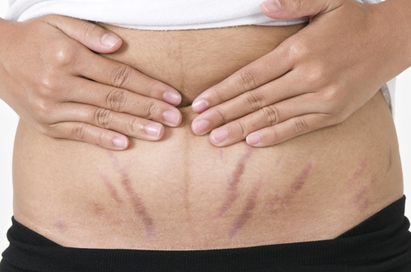 زيت عضوي. خصائص مفيدة ، وصفات للاستخدام في التجميل لبشرة الوجه والجسم والشعر