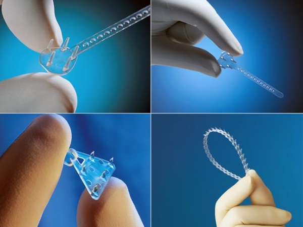 Endoscopia para levantamento de testa e sobrancelha. Fotos antes e depois, como é feito, consequências, avaliações