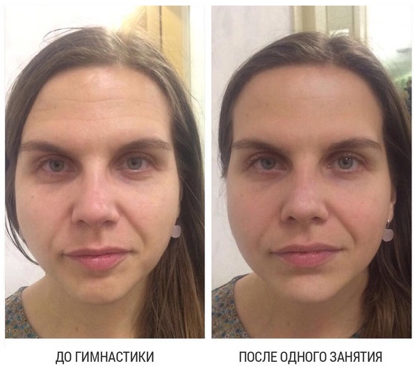 การออกกำลังกายสำหรับใบหน้าสำหรับใบหน้า วิธีการของญี่ปุ่น Elena Karkukli, Dubinina, Anastasia Burdyug บทเรียนวิดีโอ