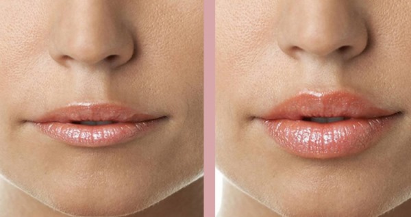 Cara menjadikan bibir lebih besar tanpa pembedahan menggunakan solek, botol, senaman di rumah