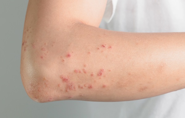Como se livrar dos pelos das mãos para sempre em mulheres, sem navalha, ferramentas, métodos, procedimentos cosméticos