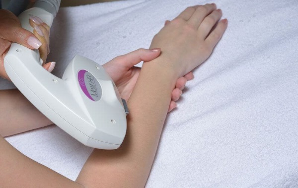 Como se livrar dos pelos das mãos para sempre em mulheres, sem navalha, ferramentas, métodos, procedimentos cosméticos