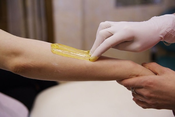 Como se livrar dos pelos das mãos para sempre em mulheres, sem navalha, ferramentas, métodos, procedimentos cosméticos