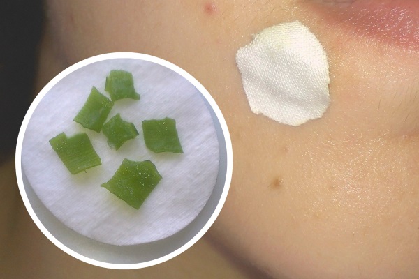 Cara menghilangkan rambut yang tumbuh ke dalam pada kaki, muka, badan selepas penyusutan, shugaring