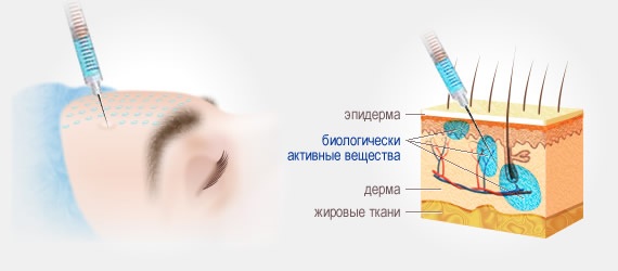 Tạo đường nét cho mũi, gò má, môi, cằm, nếp gấp rãnh mũi má. Nó được thực hiện như thế nào, giá cả, đánh giá
