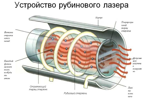 Најбољи ласерски епилатори за кућну употребу. Професионална оцена, прегледи