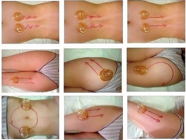 Cách massage giảm béo bụng và hai bên hông: hút chân không, Trung Quốc, chống cellulite nội tạng, dẫn lưu bạch huyết