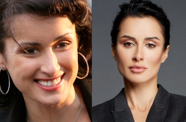Tina Kandelaki. Ảnh chụp áo tắm, trước và sau khi phẫu thuật thẩm mỹ, không trang điểm, photoshop