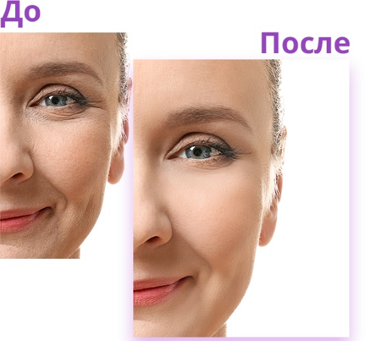 Биогени третман лица. Пре и после фотографија, ефекти, цена, прегледи