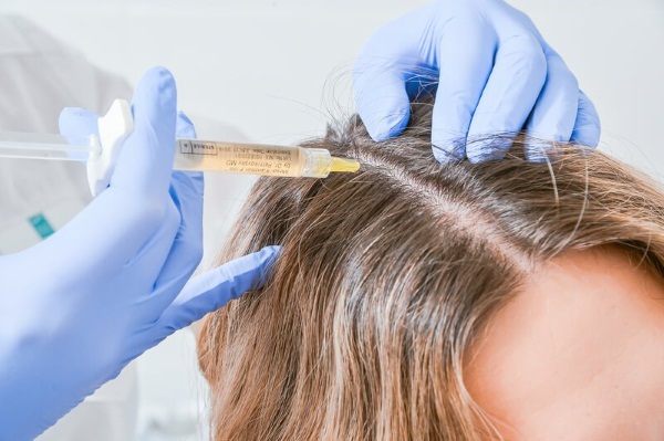 Dermahil cho tóc trong liệu pháp mesotherapy. Thành phần, ảnh trước và sau, hướng dẫn sử dụng