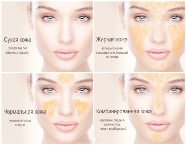 Mesovarton cho khuôn mặt. Ảnh trước và sau, giá cả, đánh giá, hậu quả