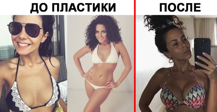 Nastya Kamenskikh. Ảnh mặc áo tắm, không trang điểm, trước và sau khi phẫu thuật thẩm mỹ, đời tư