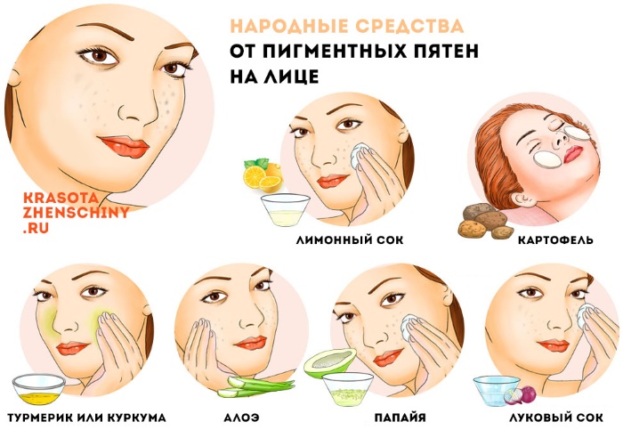 Брзо уклоните пигментацију са лица код куће. Креме, народни лекови
