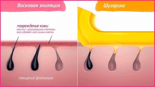 Tẩy lông / triệt lông tại nhà bằng sáp / đường / mật ong, shugaring. Cách làm, công thức nấu ăn