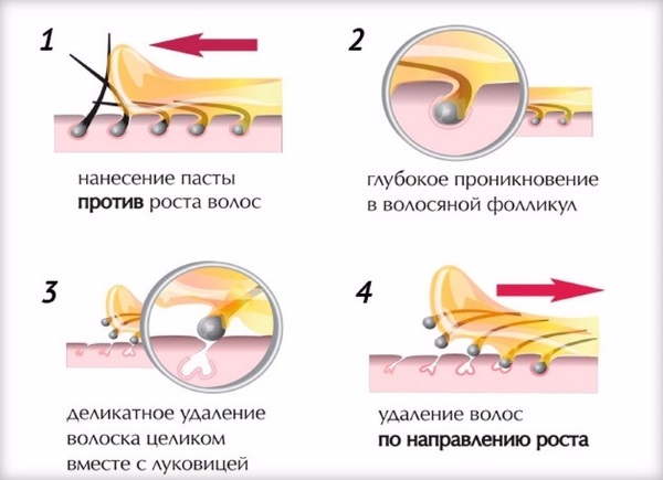 Tẩy lông / triệt lông tại nhà bằng sáp / đường / mật ong, shugaring. Cách làm, công thức nấu ăn