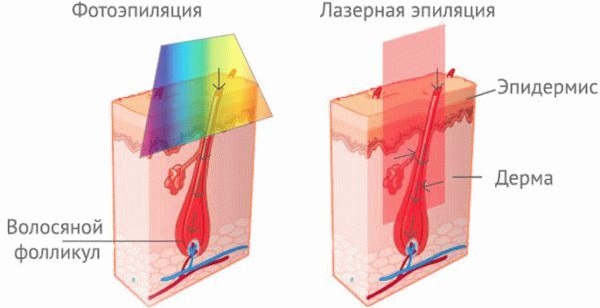 Tẩy lông / triệt lông tại nhà bằng sáp / đường / mật ong, shugaring. Cách làm, công thức nấu ăn