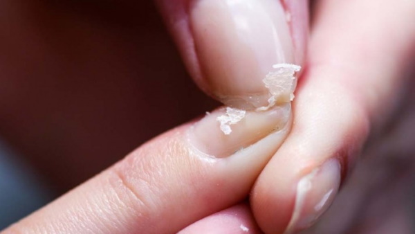 Eveline (Evelyn) 8 em 1 Unhas saudáveis. Instruções para uso de verniz, preço, análogos, comentários