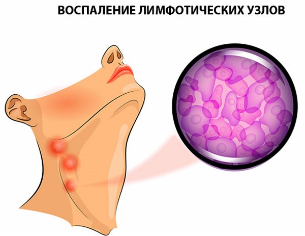 Massage chân không với lon cho cellulite trên bụng và hai bên. Hình ảnh, đánh giá, cách làm đúng