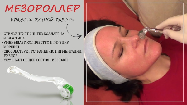 Mesotherapy quanh mắt trị thâm quầng, thâm, túi, phù nề. Ảnh trước và sau, giá cả, đánh giá