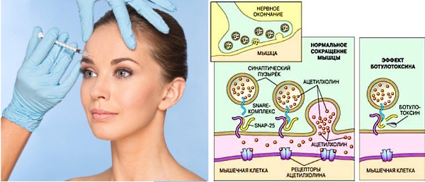 Refinex في التجميل. الفعالية ، الآثار الجانبية للاستخدام ، مراجعات لأخصائيي التجميل