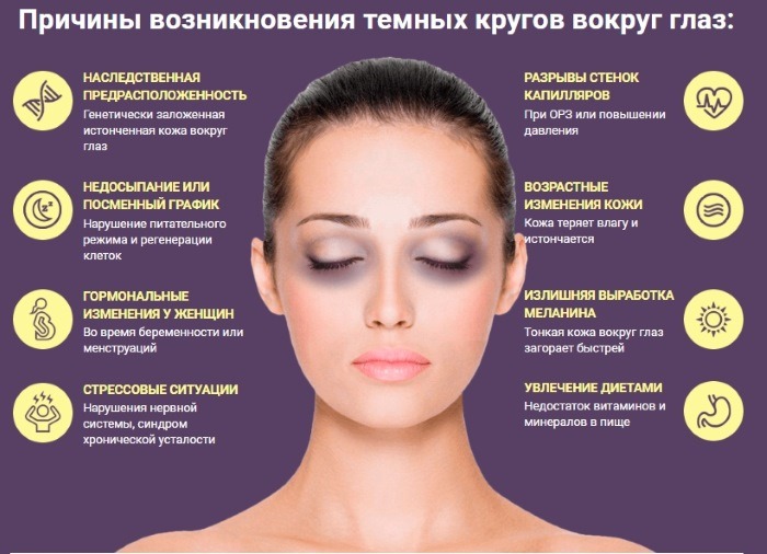 Модрице испод очију. Разлози за жене, како се отарасити, лечење, од чега након 30 година