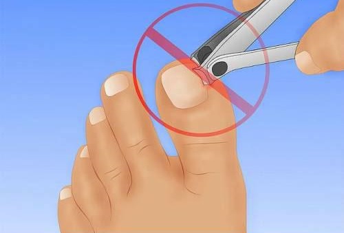 Serum Arcade para unhas. Como usar, análogos, comentários