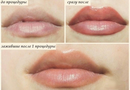 Tatuagem labial. Fotos de antes e depois, consequências, avaliações