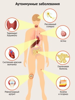علاج Ulthera (Altera) في تجميل الأجهزة. قبل وبعد الصور والسعر والمراجعات